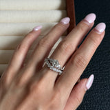 L’Align Ring