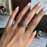 L’Align Ring